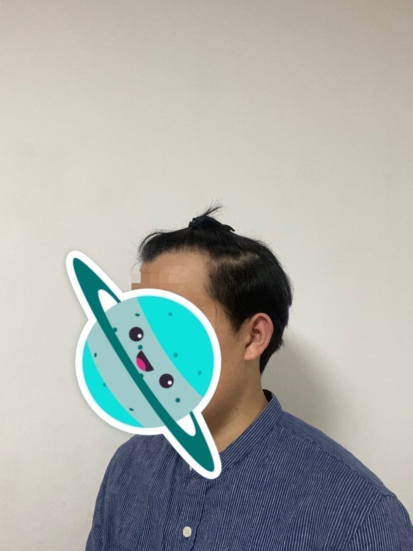 수술전