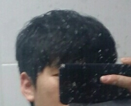 머리빠지기전