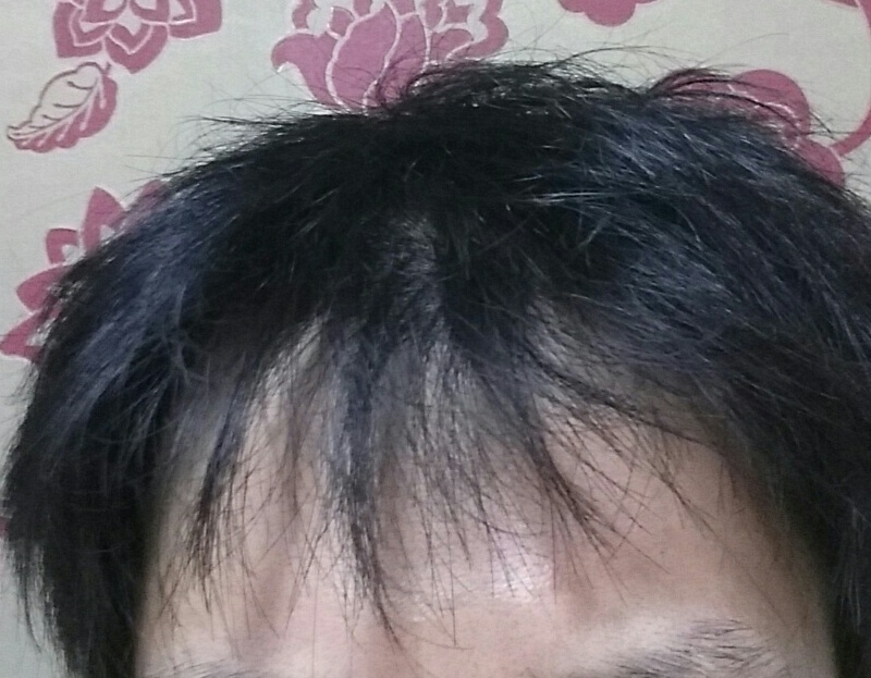 빠진후