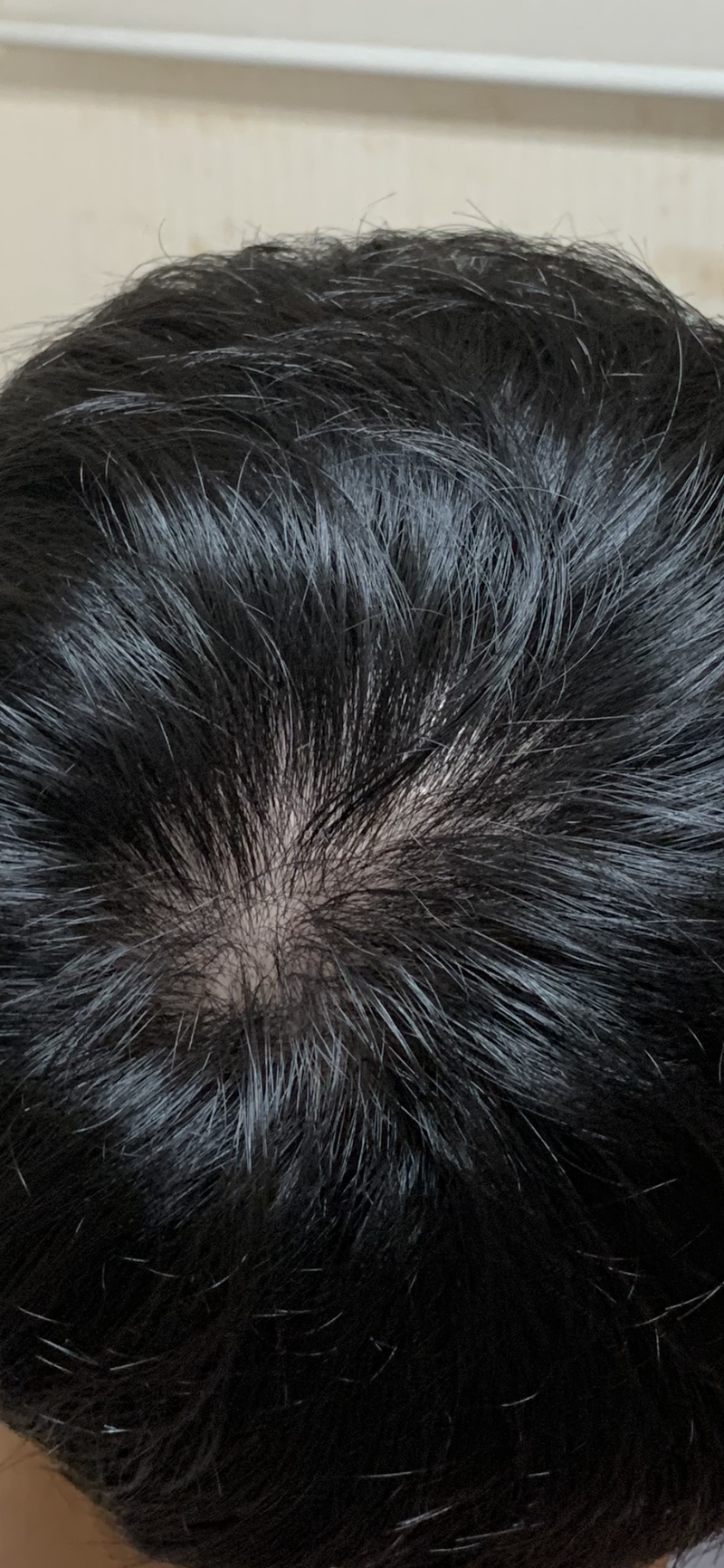 081E2CF0-C100-4A0D-A13B-34E5F937648C.png
