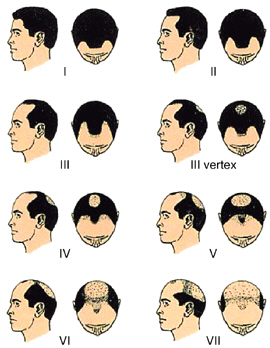XHnU6aVHkLvRJdWIA7sFajiiVHpJAbW.jpg