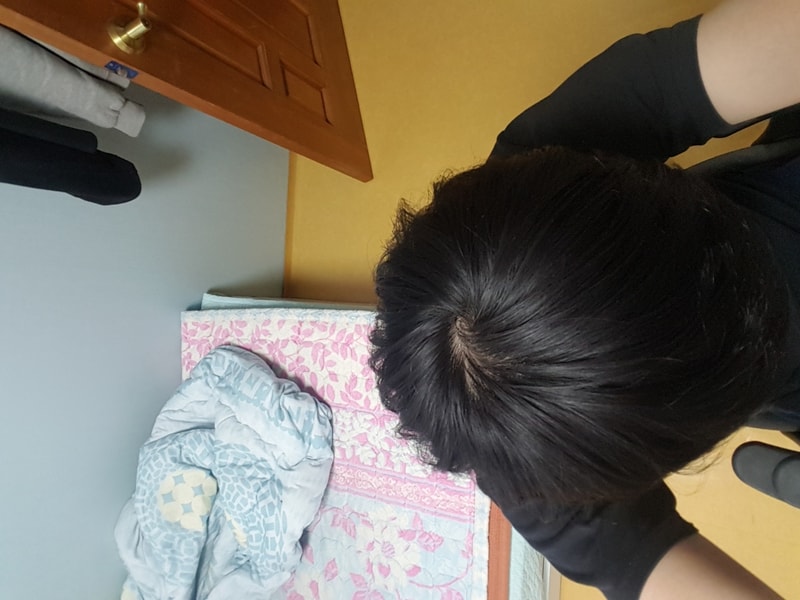 현재 정수리.jpg
