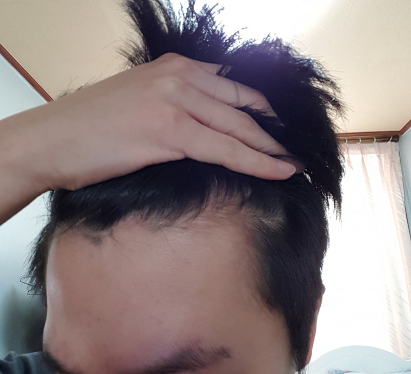 2주전 앞머리.jpg