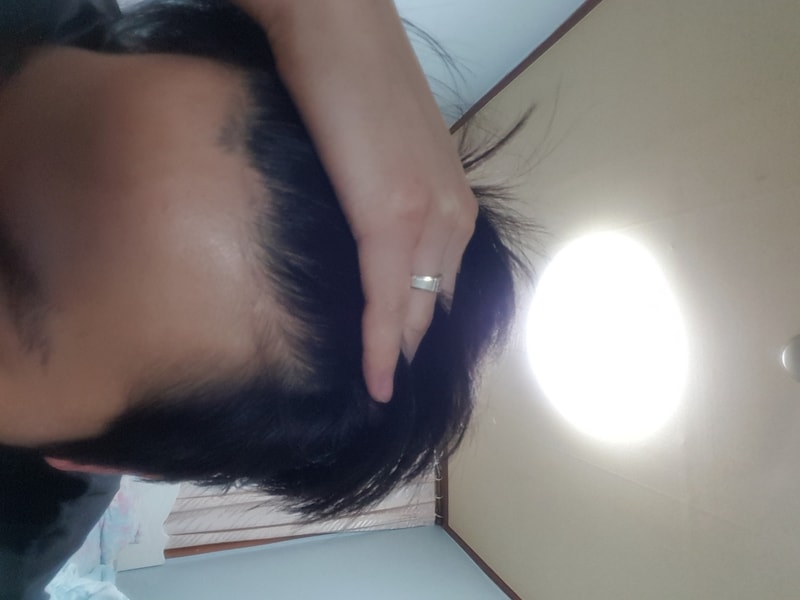 현재 앞머리.jpg