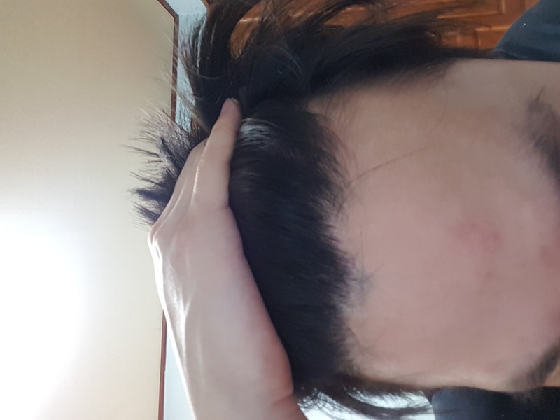 현재 앞머리.jpg