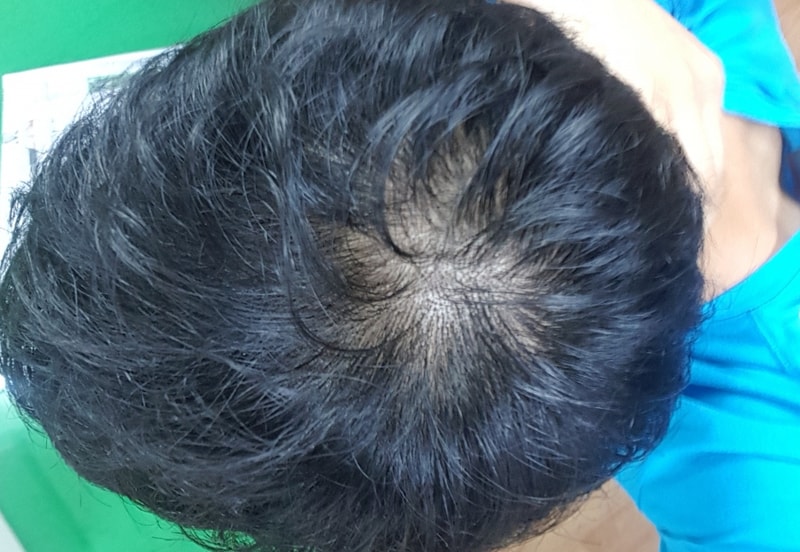 20170815_124239.jpg
