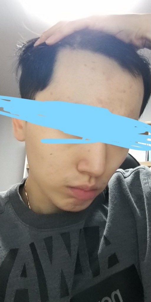 InkedKakaoTalk_20181108_125825432_LI.jpg