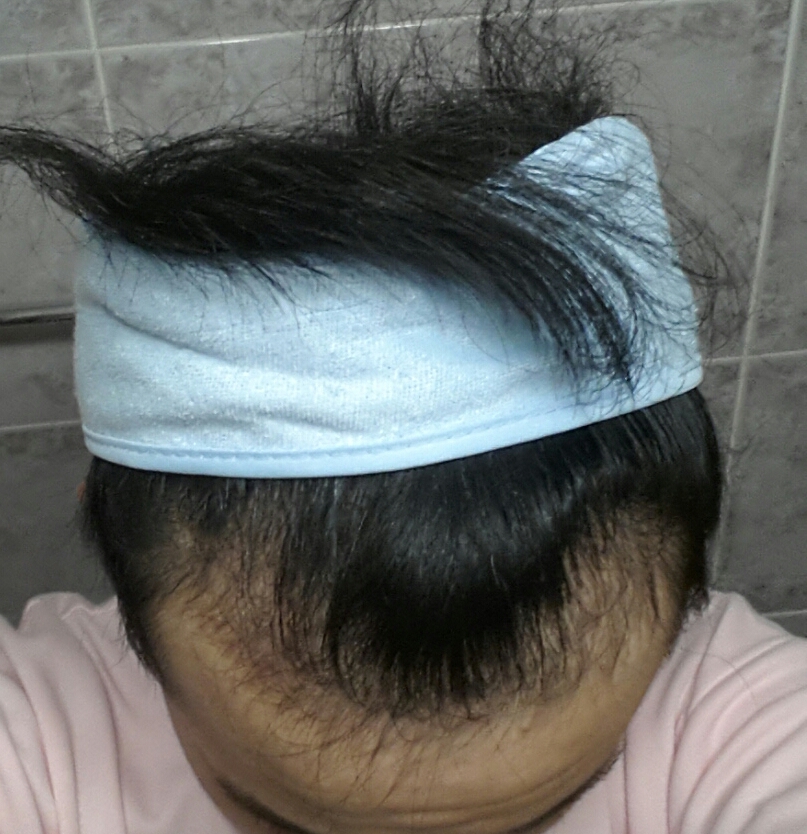 이마 사진