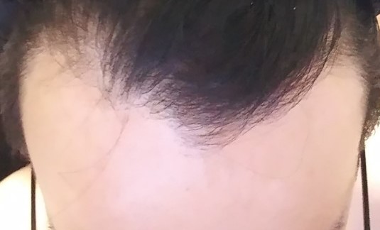 KakaoTalk_20180729_203522772.jpg