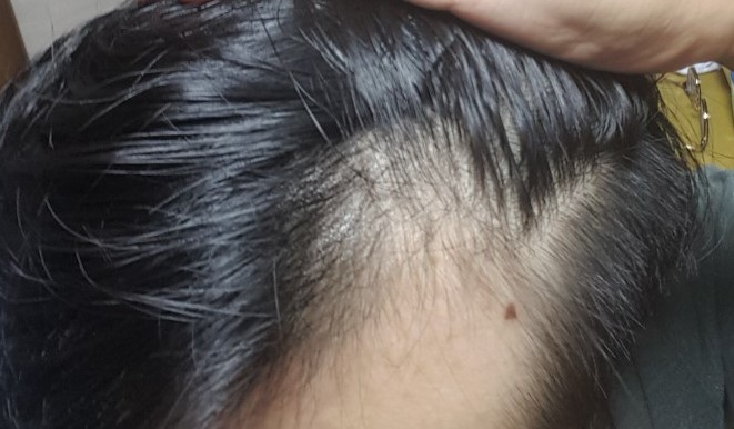 KakaoTalk_20180825_233130768.jpg