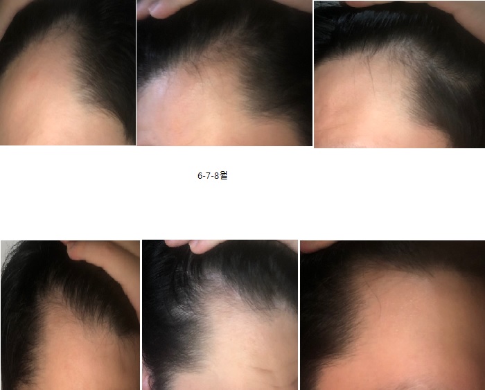 앞머리.jpg