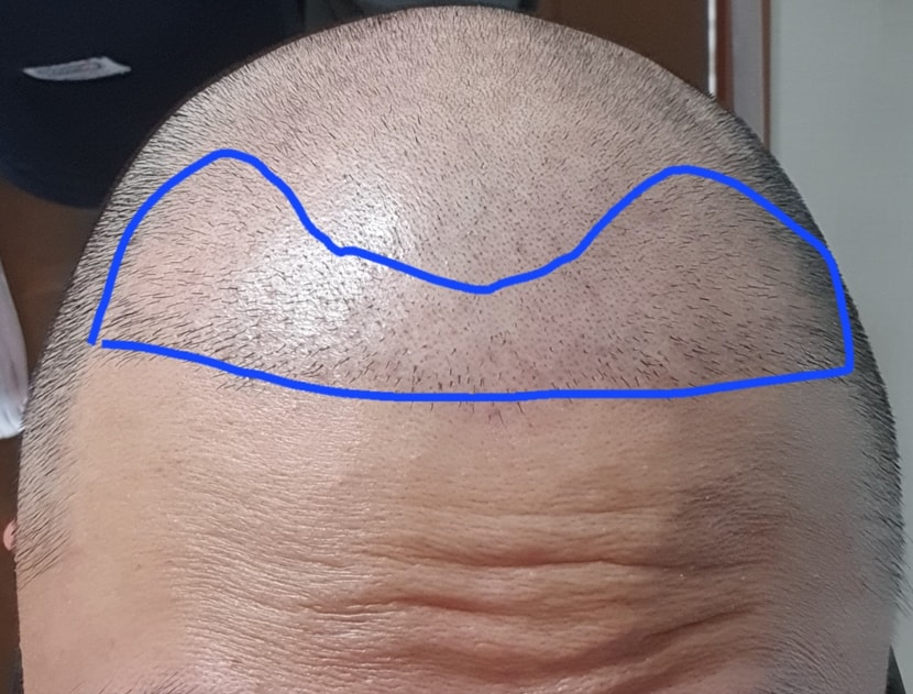 파란색 부분 3000모정도 진행했던걸로 기억합니다