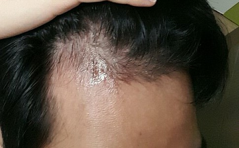 KakaoTalk_20170318_022052223.jpg