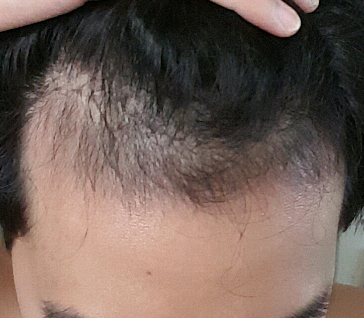 20170731_152339.jpg