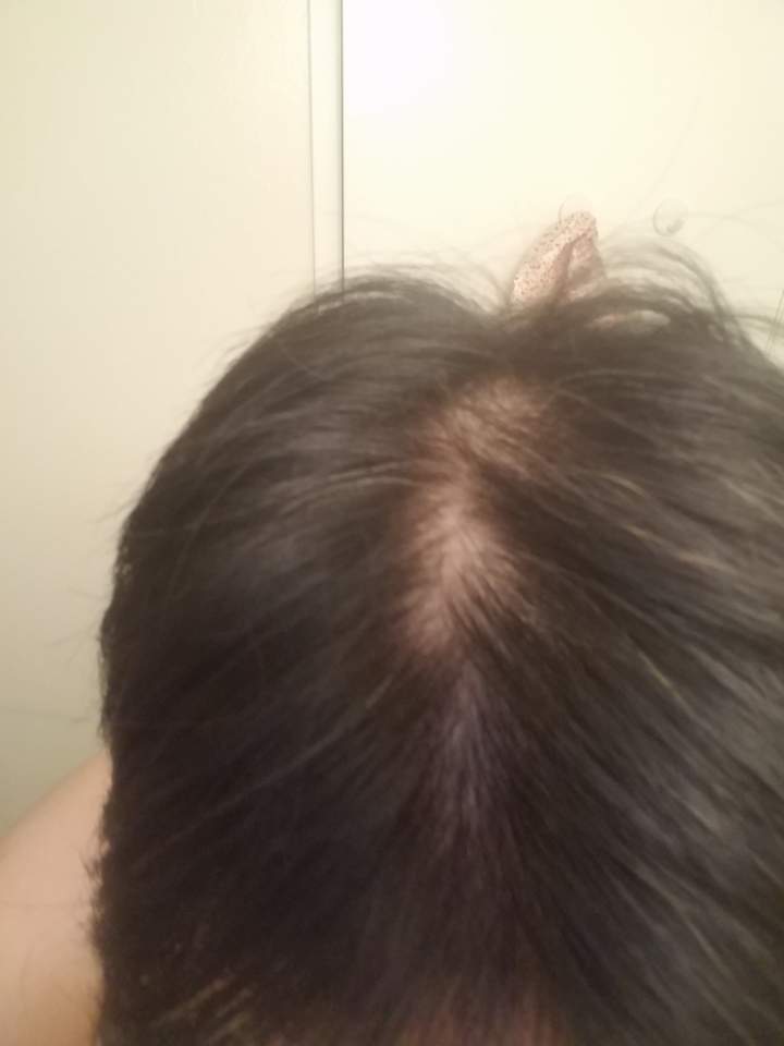 KakaoTalk_20180729_230229780.jpg