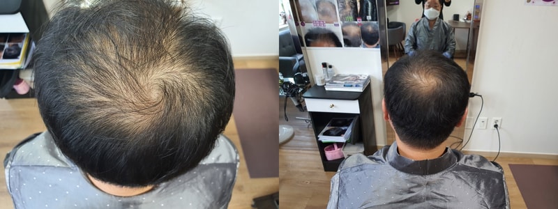 , 40대, 1주일 1회 총 10회.jpg