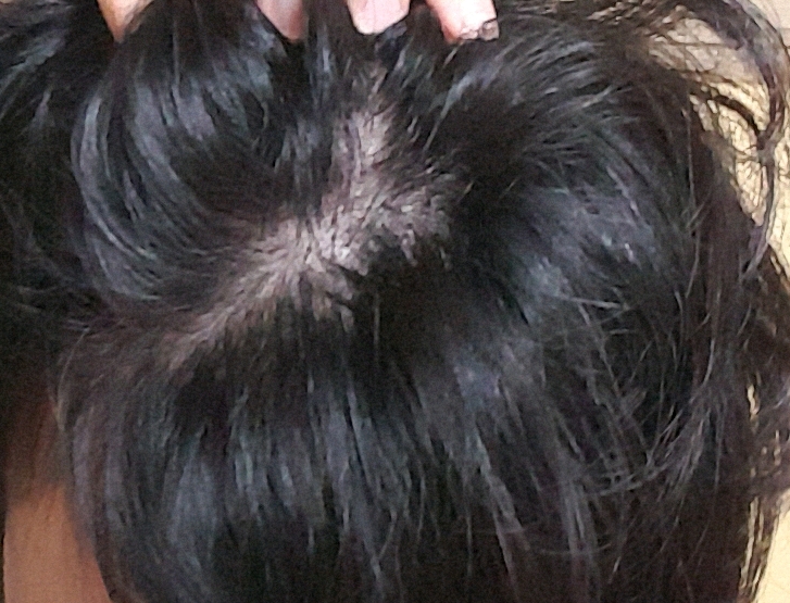 20171125_203124.jpg