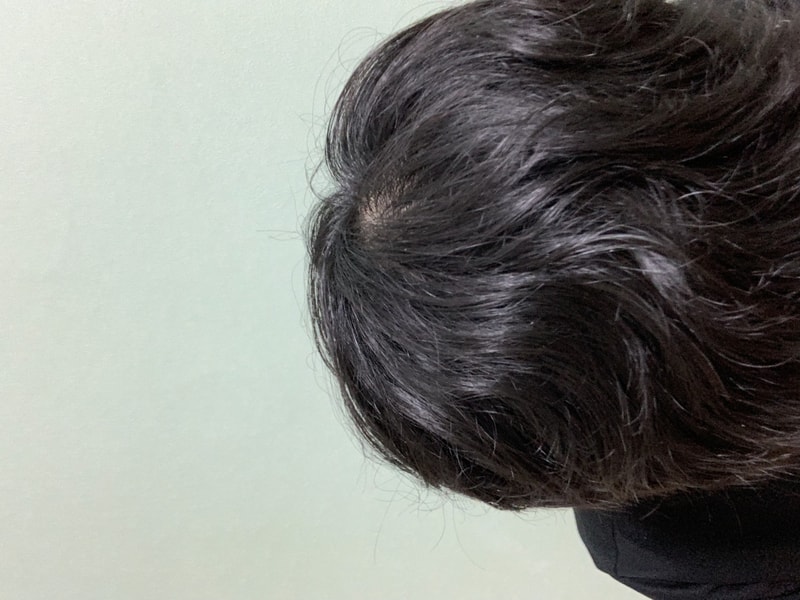 AE26874C-6D54-4ED2-BBE7-EBF05AA4FE0A.jpeg