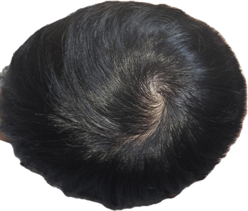 1000015766.png