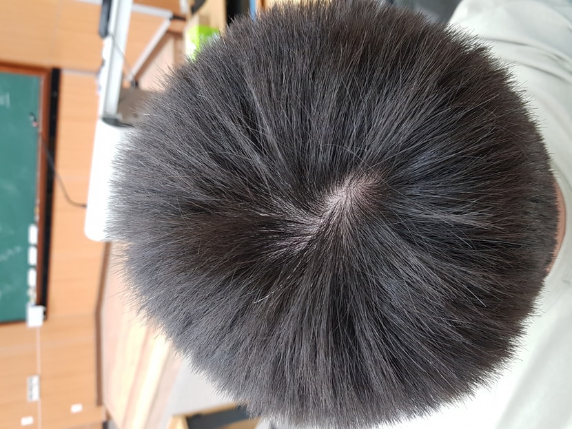 23년 5월 18일 정수리