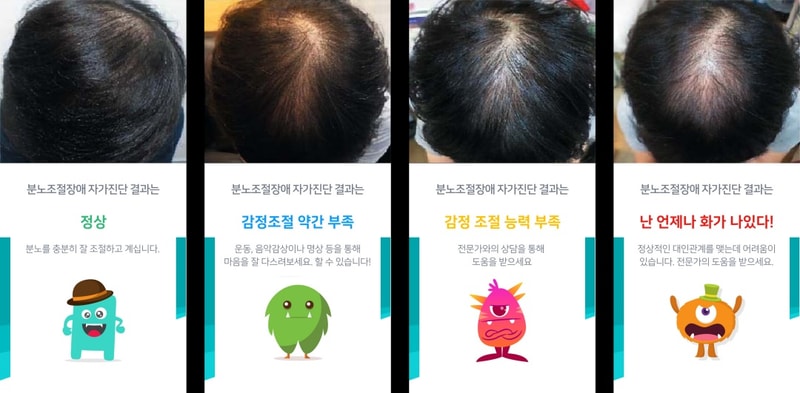 201027_탈모 상단 마케팅.jpg
