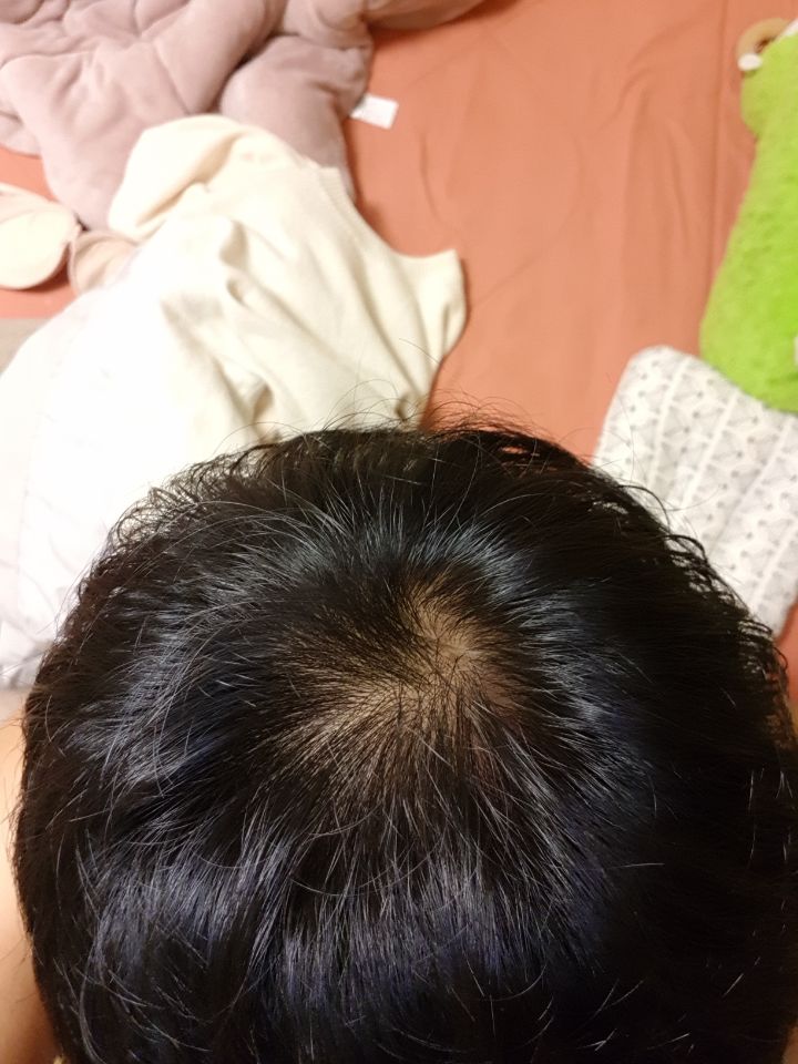 머리일반.jpg
