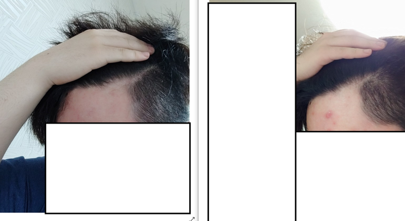 11111.png