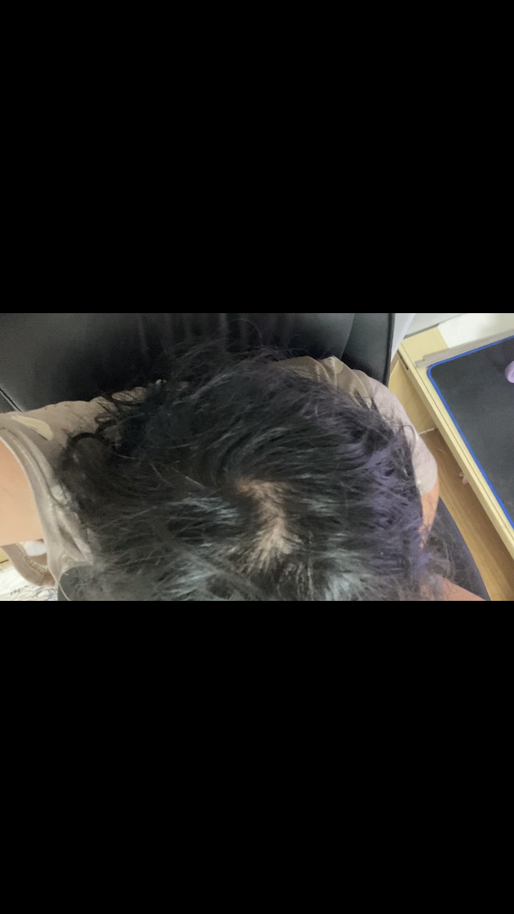 915BD831-D20C-428A-951C-23396C60B6DB.png