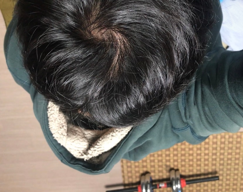 정수리와 뒷머리 사이