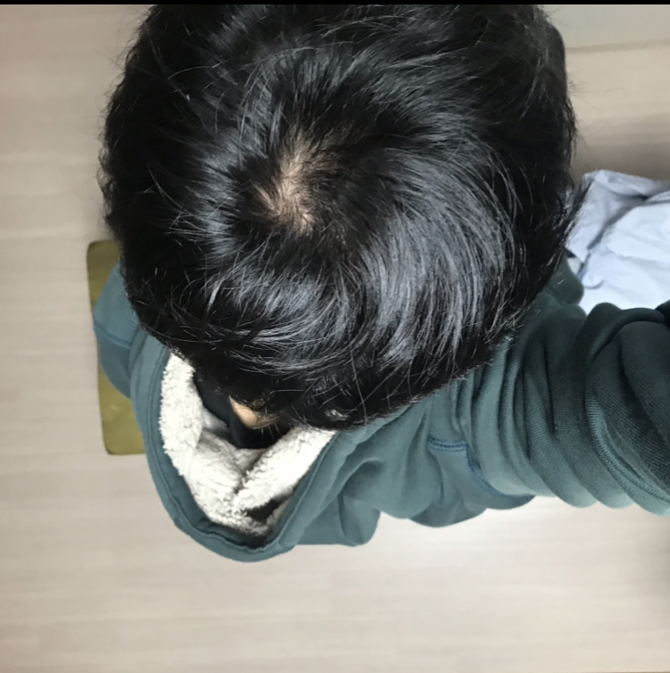 정수리