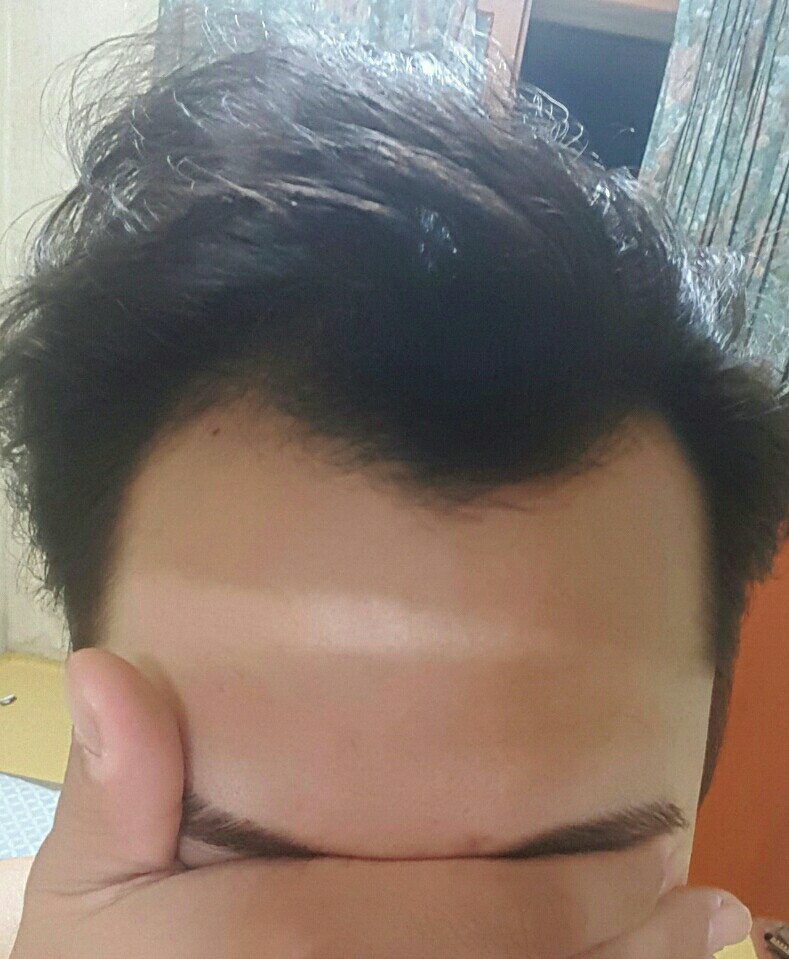 M탈모.jpg