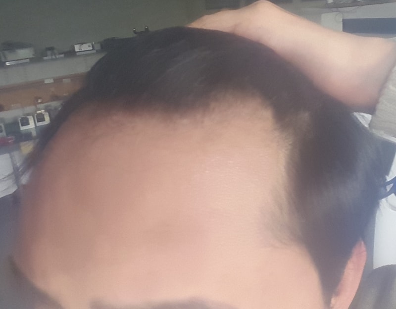 좌측.jpg