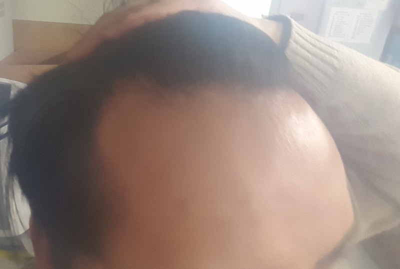 우측.jpg