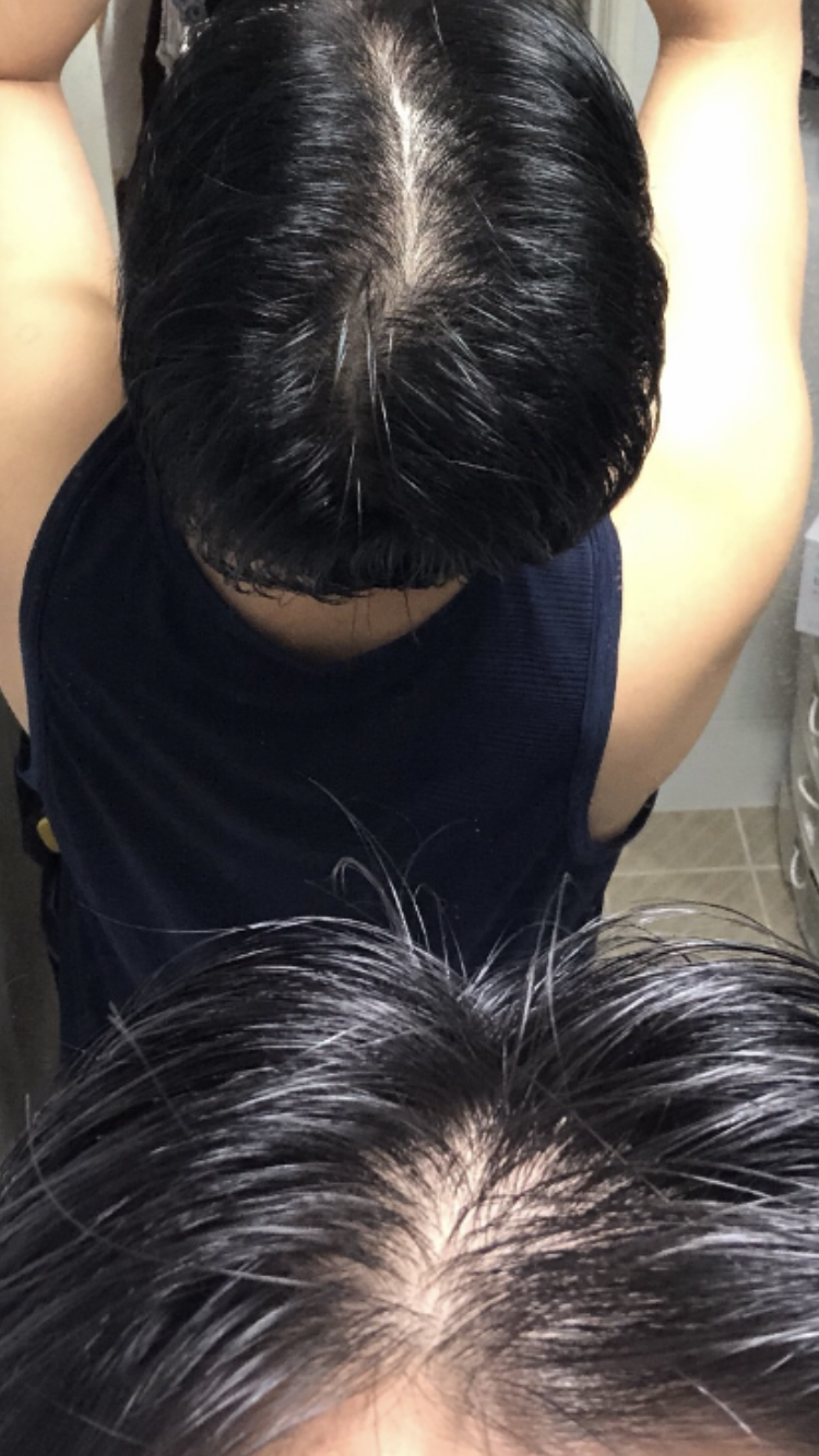 E8D905E0-B44B-4631-85E5-419AF16BDC9D.png