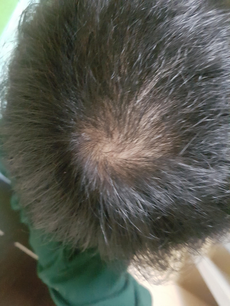 20170717_210619.jpg
