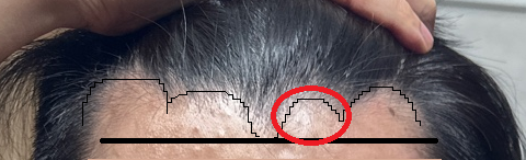 99.png