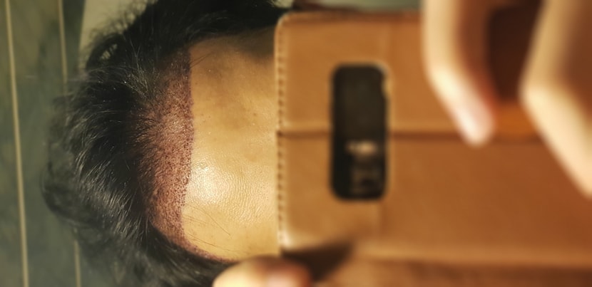 방금 ㅠ