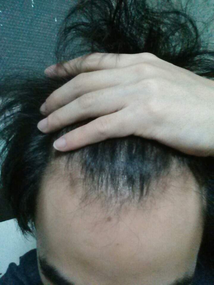 11.png