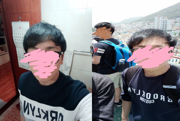크기변환_탈모 ㅠㅠ.jpg