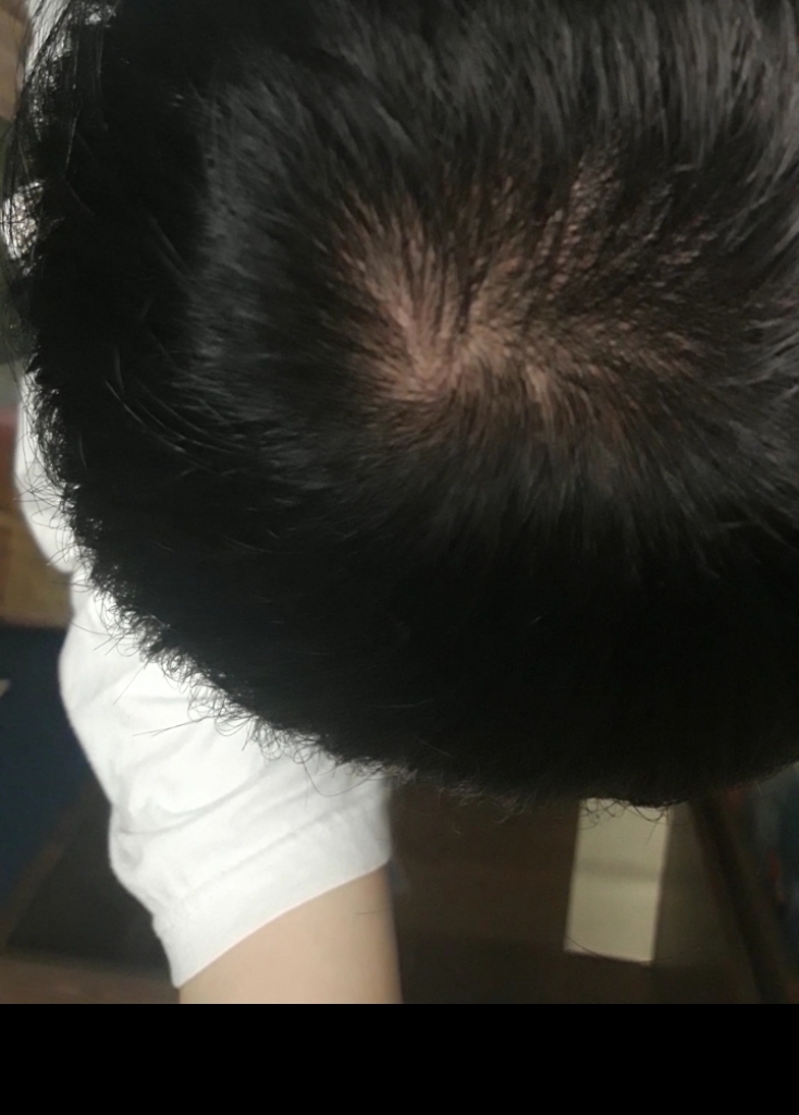 20190304_181848.jpg