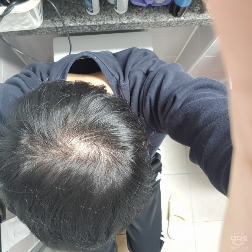 2개월차