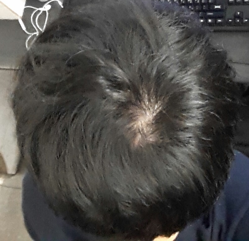 20170125_102728-1.jpg