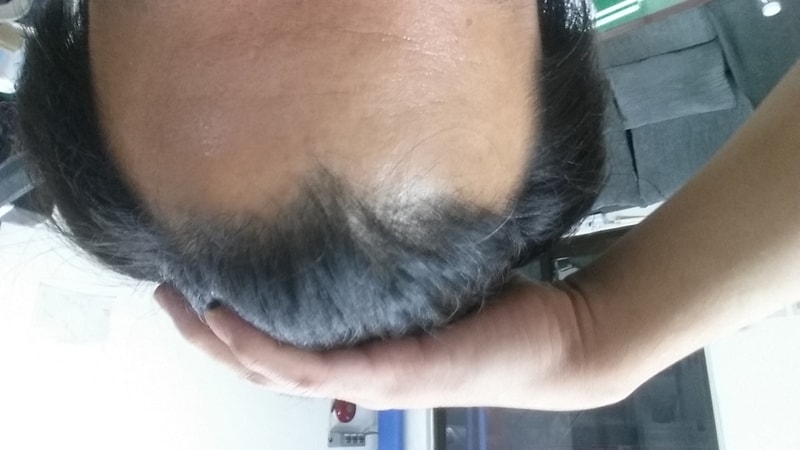 20171119_221146.jpg