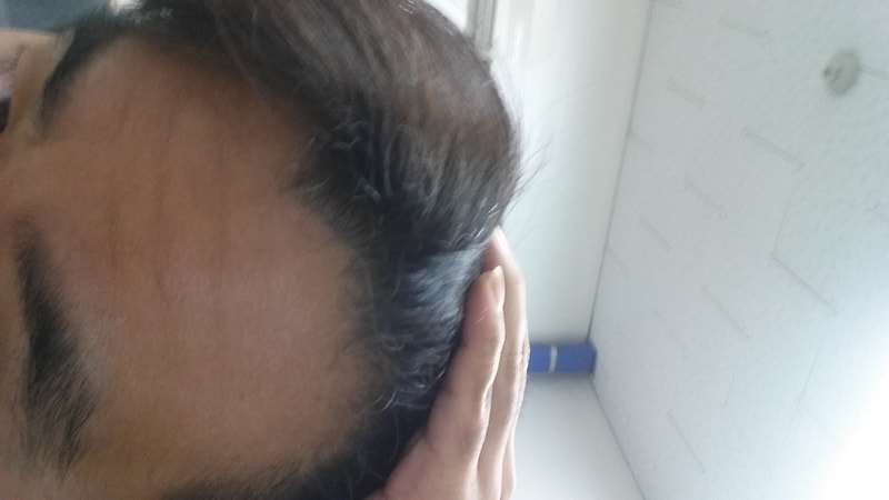 20171119_221038.jpg