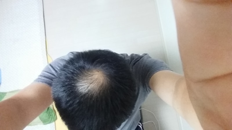20170625_204526.jpg