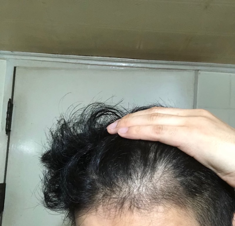 1머리감고나서바로 왼쪽.jpeg