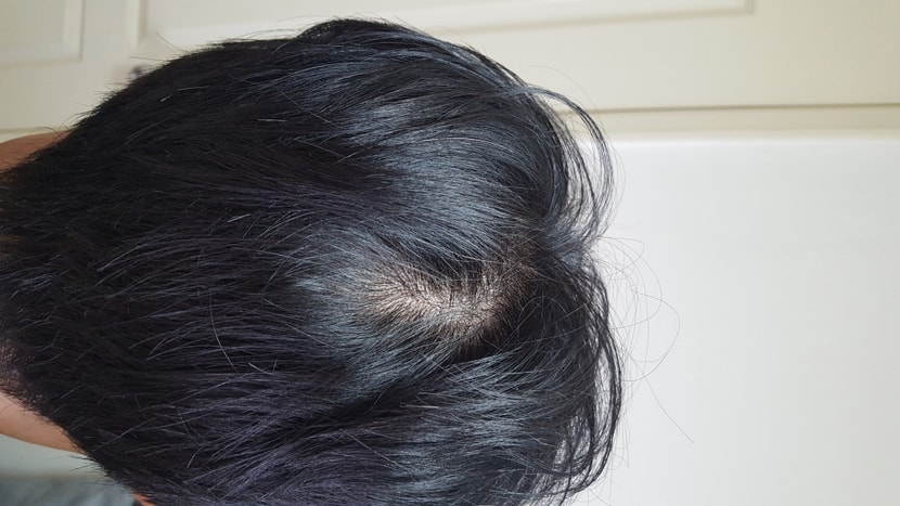 자고 일어난 직후 뒤통수