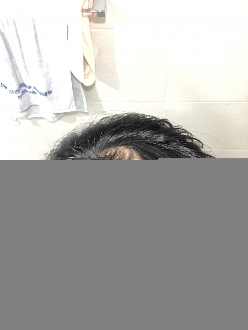 7개월전 (2)