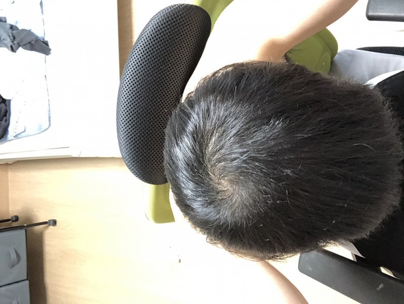 정수리.jpeg