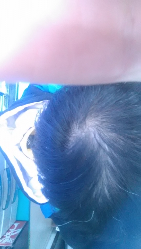 20141225_045203.jpg